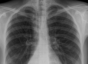 Screen Shot 2015-08-05 at 10.36.04 AM